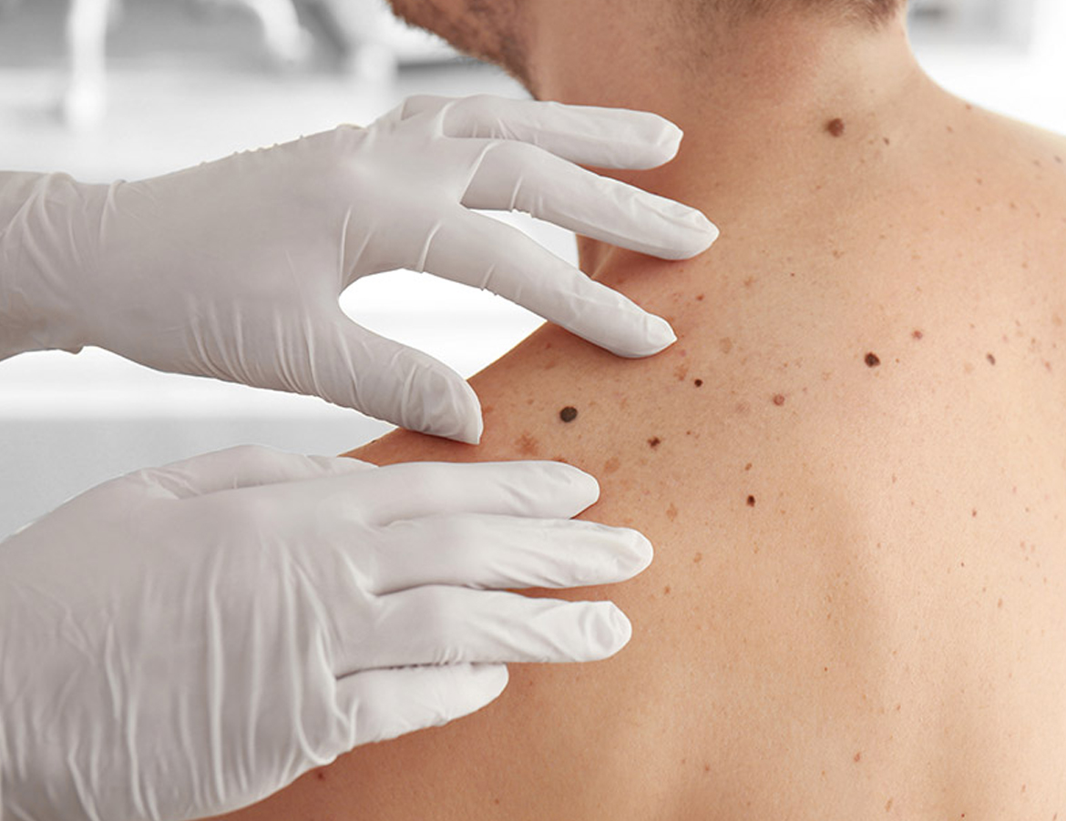 Visita dermatologica